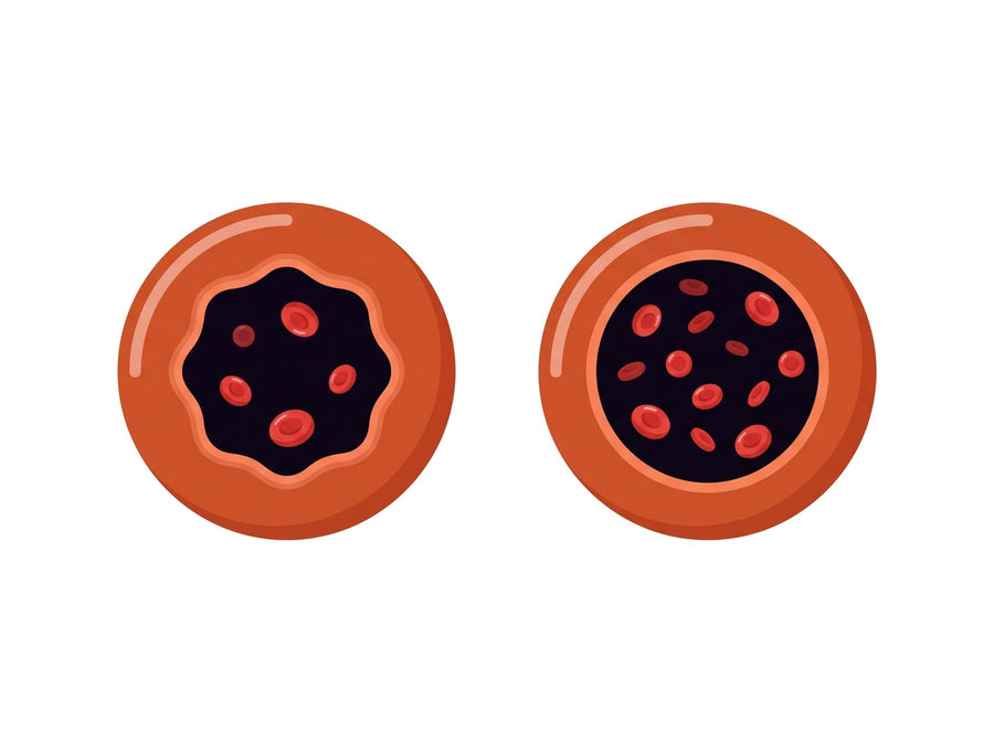 Two blood vessel cross-sections, one narrower and one open